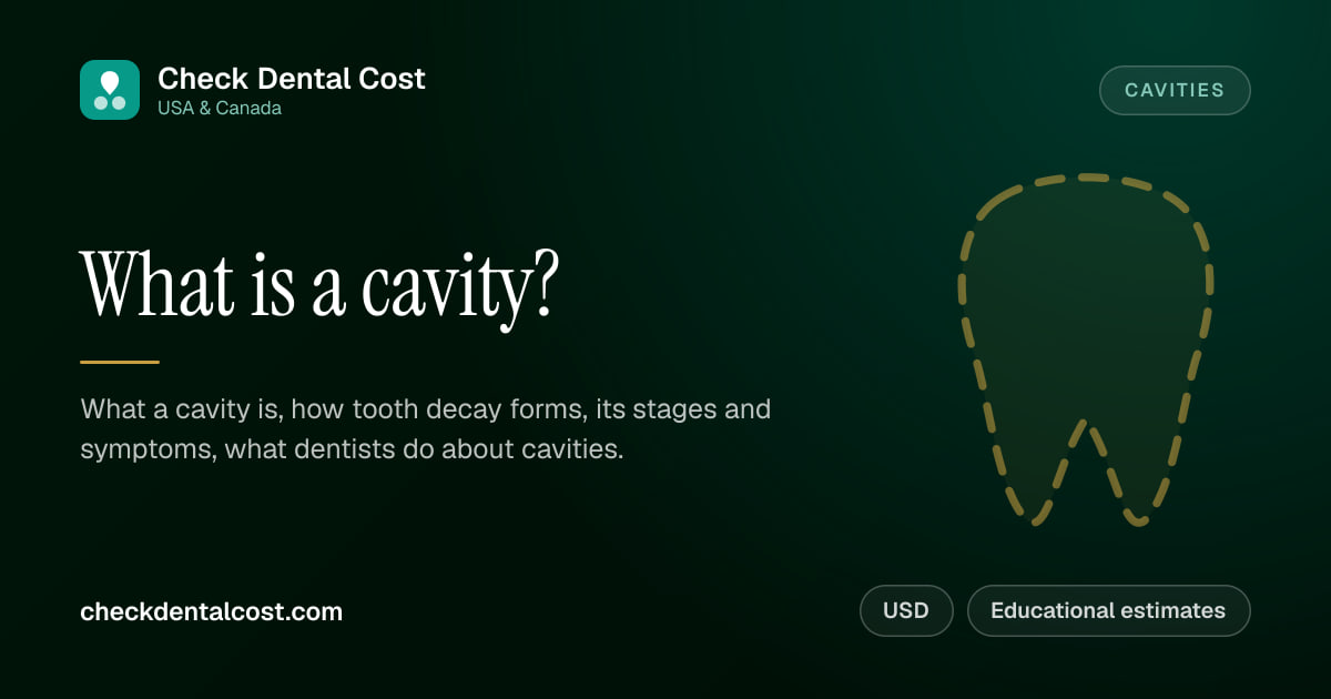 What Is a Cavity? Stages, Symptoms and What Dentists Do About It